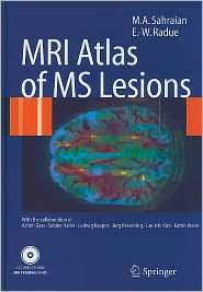 MRI Atlas of MS Lesions, (3540713719), Sahraian, Textbooks   Barnes 