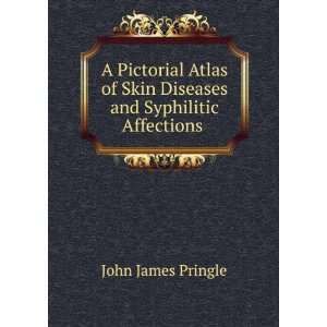   Skin Diseases and Syphilitic Affections . John James Pringle Books