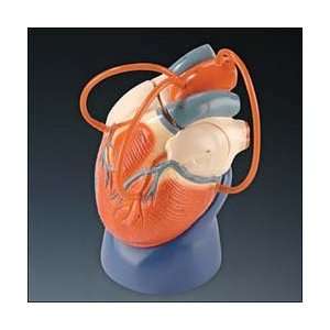 Life Size Heart Model   Coronary Bypass Edition:  